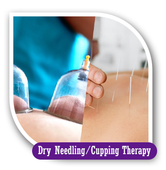 Dry Needling