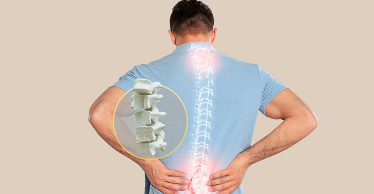 Osteoporosis treatment in mumbai